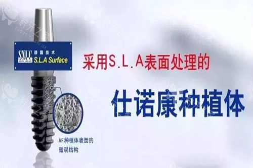 仕诺康植体型号一览表！5大系列完整对比+价格指南！