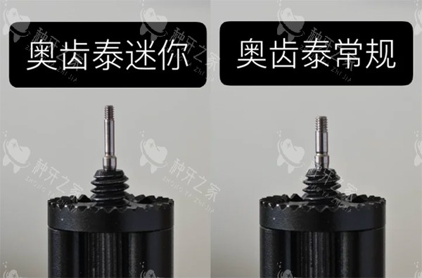 丹特因和奥齿泰哪个好？谁更耐用看三个数据区别！