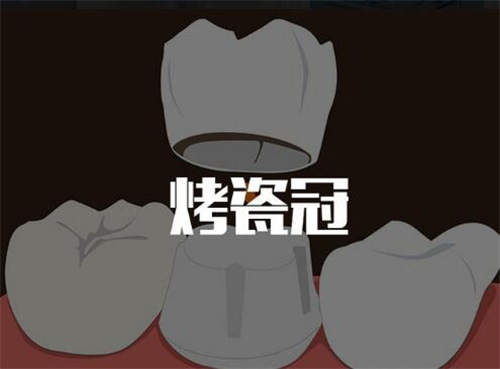 贵州遵义齿度口腔种植牙项目的价格速看！