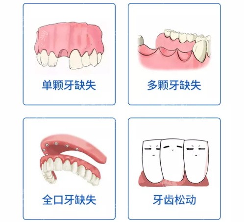 单颗多颗全口牙齿缺失及牙齿松动漫画图 单颗多颗全口牙齿缺失及牙齿松动漫画图