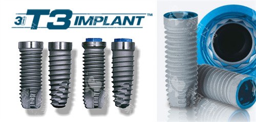 美国3I种植牙不同型号 美国3I种植牙不同型号