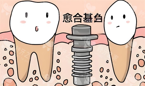 大同种牙口碑榜:只推荐本地老友认证的良心牙科